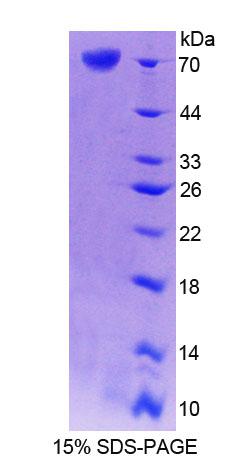 Recombinant Cartilage Associated Protein (CRTAP)