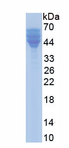 Recombinant Cytoplasmic Linker Associated Protein 2 (CLASP2)