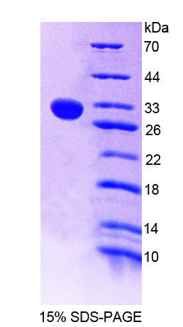 Recombinant Chitinase 1 (CHIT1)