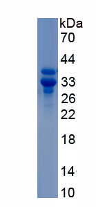 Recombinant Calponin 2 (CNN2)