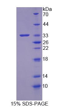 Recombinant Calponin 1, Basic (CNN1)