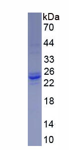 Recombinant Slingshot Homolog 2 (SSH2)