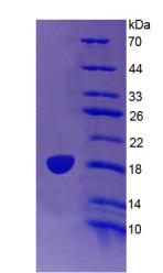 Recombinant Lecithin Cholesterol Acyltransferase (LCAT)