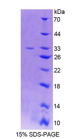 Recombinant Lactase (LCT)