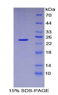 Recombinant Dishevelled, Dsh Homolog 1 (DVL1)