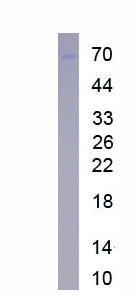 Recombinant Bcl2/Adenovirus E1B 19kDa Interacting Protein 3 (BNIP3)