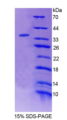 Recombinant Bridging Integrator 2 (BIN2)