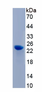 Recombinant Actin Related Protein 2/3 Complex Subunit 5 (ARPC5)