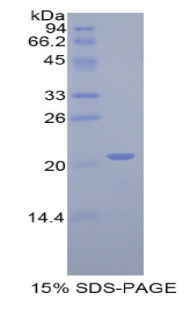 Recombinant Actin Related Protein 2/3 Complex Subunit 4 (ARPC4)