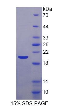 Recombinant Alpha-Methylacyl Coenzyme A Racemase (aMACR)