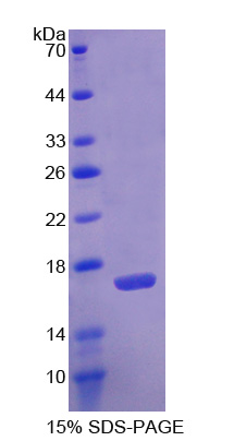 Recombinant Agmatine Ureohydrolase (AGMAT)