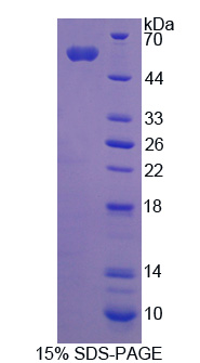 Recombinant Activity Dependent Neuroprotector Protein (ADNP)