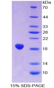 Recombinant Aconitase 1 (ACO1)