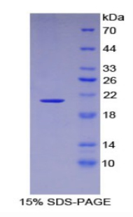 Recombinant Aconitase 1 (ACO1)