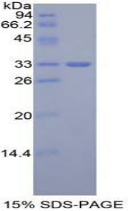 Recombinant GLI Family Zinc Finger Protein 3 (GLI3)