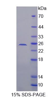 Recombinant Succinate Dehydrogenase Complex Subunit B (SDHB)