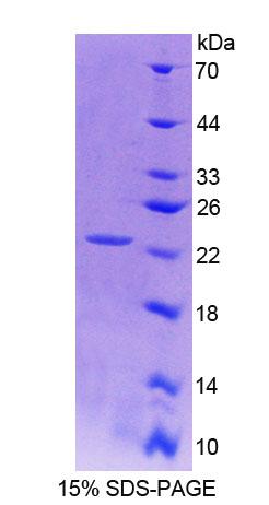 Recombinant Von Hippel Lindau Tumor Suppressor (vHL)