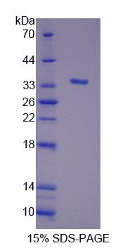 Recombinant Hydroxyacyl Coenzyme A Dehydrogenase Beta (HADHb)