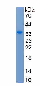 Recombinant Tyrosine 3/Tryptophan 5 Monooxygenase Activation Protein Epsilon (YWHAe)