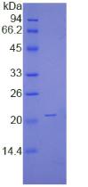 Recombinant Non Metastatic Cells 1, Protein NM23A Expressed In (NME1)