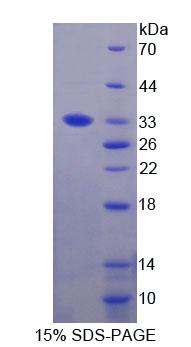 Recombinant Phosphoinositide-3-Kinase Catalytic Delta Polypeptide (PIK3Cd)