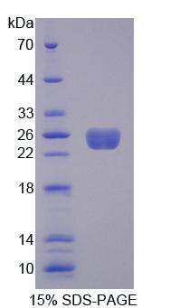 Recombinant Rho Guanine Nucleotide Exchange Factor 7 (ARHGEF7)
