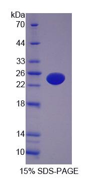 Recombinant AF4/FMR2 Family, Member 1 (AFF1)