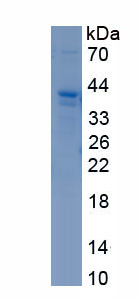 Recombinant Engrailed Homeobox Protein 2 (EN2)