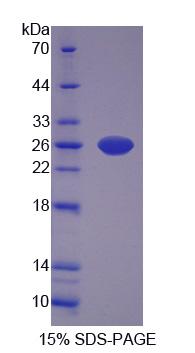 Recombinant Carnosine Synthase 1 (CARNS1)
