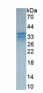 Recombinant Four And A Half LIM Domains Protein 1 (FHL1)