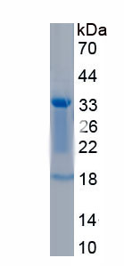 Recombinant Budding Uninhibited By Benzimidazoles 1 (BUB1)