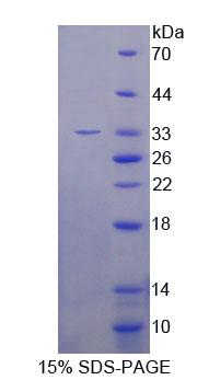 Recombinant Snail Homolog 1 (SNAI1)