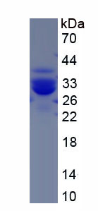 Recombinant DNA Repair Protein RAD50 (RAD50)