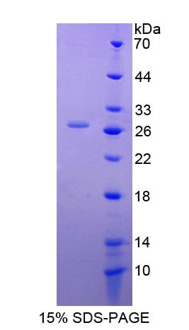 Recombinant DnaJ/HSP40 Homolog Subfamily C, Member 12 (DNAJC12)