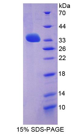 Recombinant Leucine Rich Repeat LGI Family, Member 3 (LGI3)