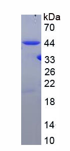 Recombinant Fanconi Anemia Complementation Group D2 (FANCD2)