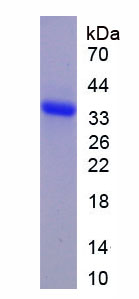 Recombinant A Disintegrin And Metalloproteinase With Thrombospondin 2 (ADAMTS2)