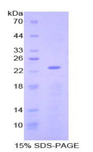 Recombinant Non Metastatic Cells 3, Protein NM23A Expressed In (NME3)