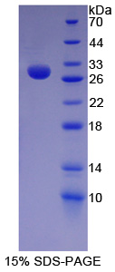 Recombinant Hairy And Enhancer Of Split 1 (HES1)
