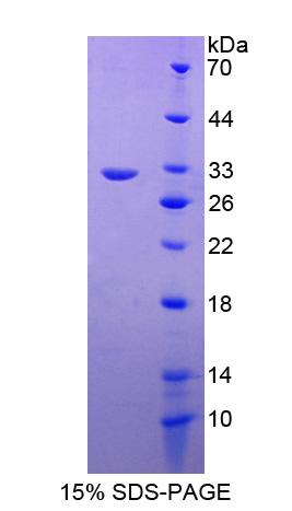 Recombinant RAB5A, Member RAS Oncogene Family (RAB5A)