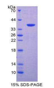 Recombinant T-Kininogen 1 (KNT1)