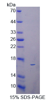 Recombinant Regenerating Islet Derived Protein 3 Beta (REG3b)