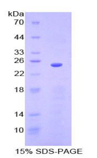 Recombinant Sprouty Homolog 3 (SPRY3)