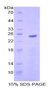 Recombinant Sprouty Homolog 2 (SPRY2)