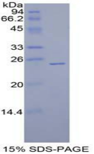 Recombinant Sprouty Homolog 1 (SPRY1)