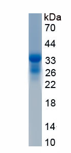 Recombinant Sal Like Protein 4 (SALL4)