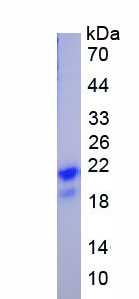 Recombinant Potassium Intermediate Small Conductance Calcium Activated Channel Subfamily N, Member 2 (KCNN2)