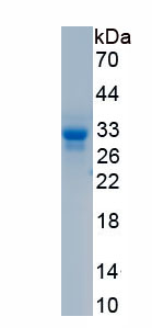 Recombinant Parkinson Disease Protein 2 (PARK2)