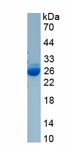 Recombinant STIP1 Homology And U-Box Containing Protein 1 (STUB1)