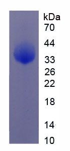 Recombinant Notch Homolog 4 (NOTCH4)